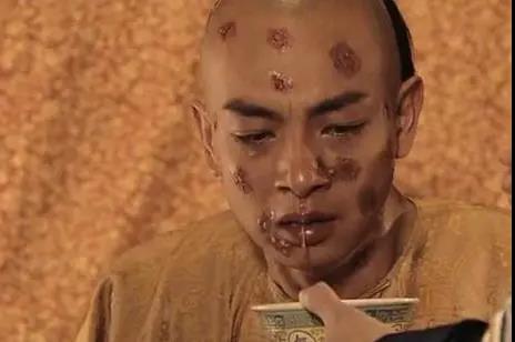 医学上听起来文艺,得了要命的疾病