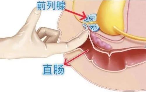 手淫会造成前列腺癌?吓得我手一紧...