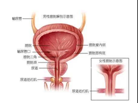 尿频、尿急当心是膀胱过度活动症