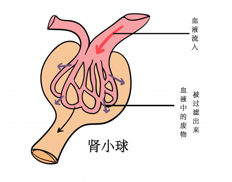 肾积水丨当肾脏里的尿液不能及时排出会发生什么？