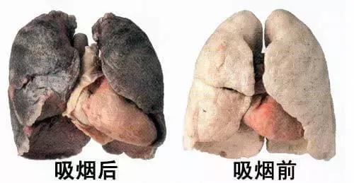 世界无烟日丨这些年对烟的误解,原来危害这么大?
