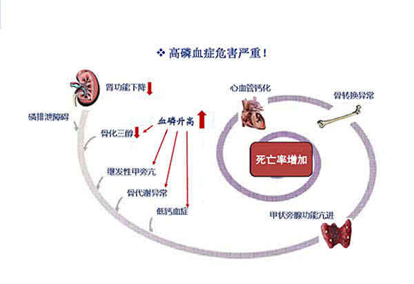 血透患者要“会吃”，磷的控制才到位