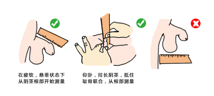 宝妈、宝爸看过来,事关男宝宝终生幸福【科普小阴茎】