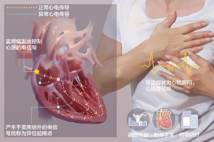 三分钟让你看懂心电图“密语”