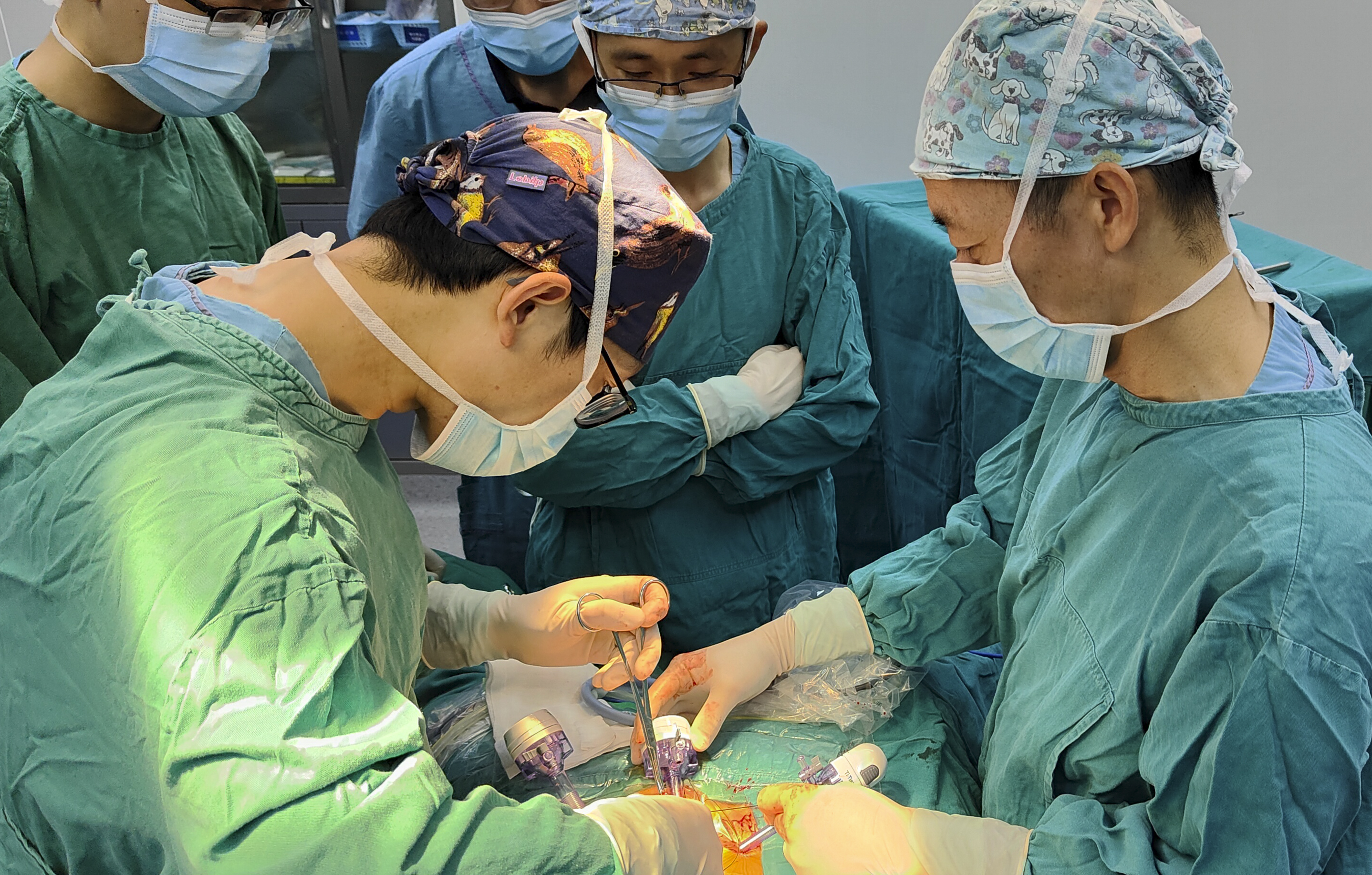 川泌首例髂总动脉嗜铬细胞瘤切除术顺利完成