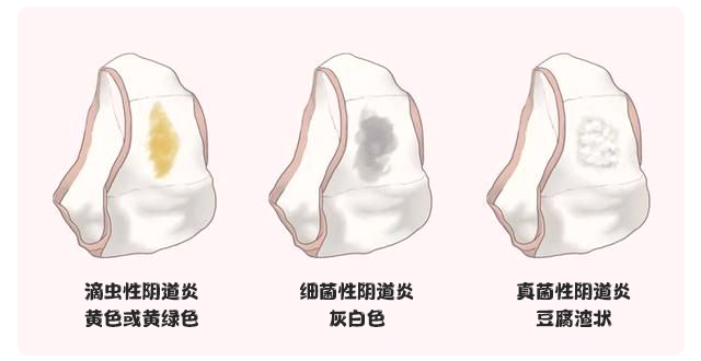 万万没想到 原来“女性之友”是它