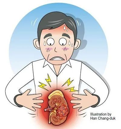 常见的泌尿系疾病有哪些？