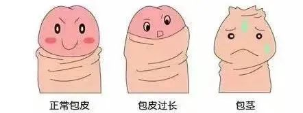 常见的泌尿系疾病有哪些？