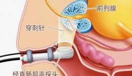 医生：3招让医生：3招让