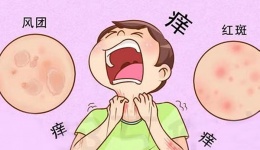 荨麻疹、皮肤痒？得了应该注意啥？