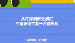 从红痒到多处溃烂：生殖感染症状千万别忽视