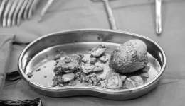 6.5厘米“鹅蛋”巨石成功取出，川泌救治甘孜藏区患者