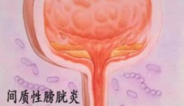 女性健康|间质性膀胱炎的“今生”