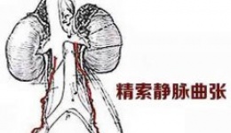科学认识青少年精索静脉曲张