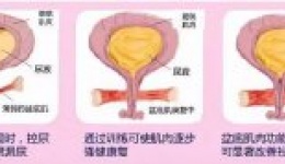 女性应该知道的盆底肌锻炼