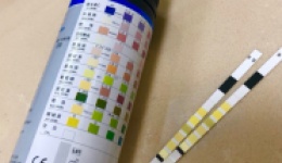 尿液检查中应该知道的一些事